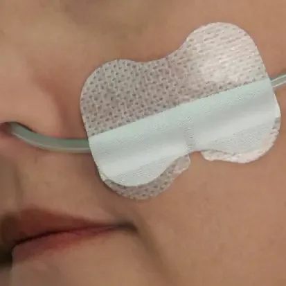GRIP-LOK – Nasal Gastric Securement Device Grip-Lok – 2100ANG