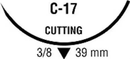 Monosof~Dermalon – Suture with Needle Nonabsorbable Uncoated Black Suture Monofilament Nylon Size 2 – 0 30 Inch Suture 1-Needle 39 mm Length 3/8 Circle Reverse Cutting Needle – SN-674