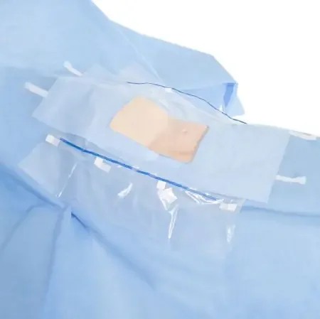 O&M Halyard – Abdominal Drape Laparoscopic / Cholecystectomy Drape 104 W X 76 W X 102 L Inch Sterile – 89538